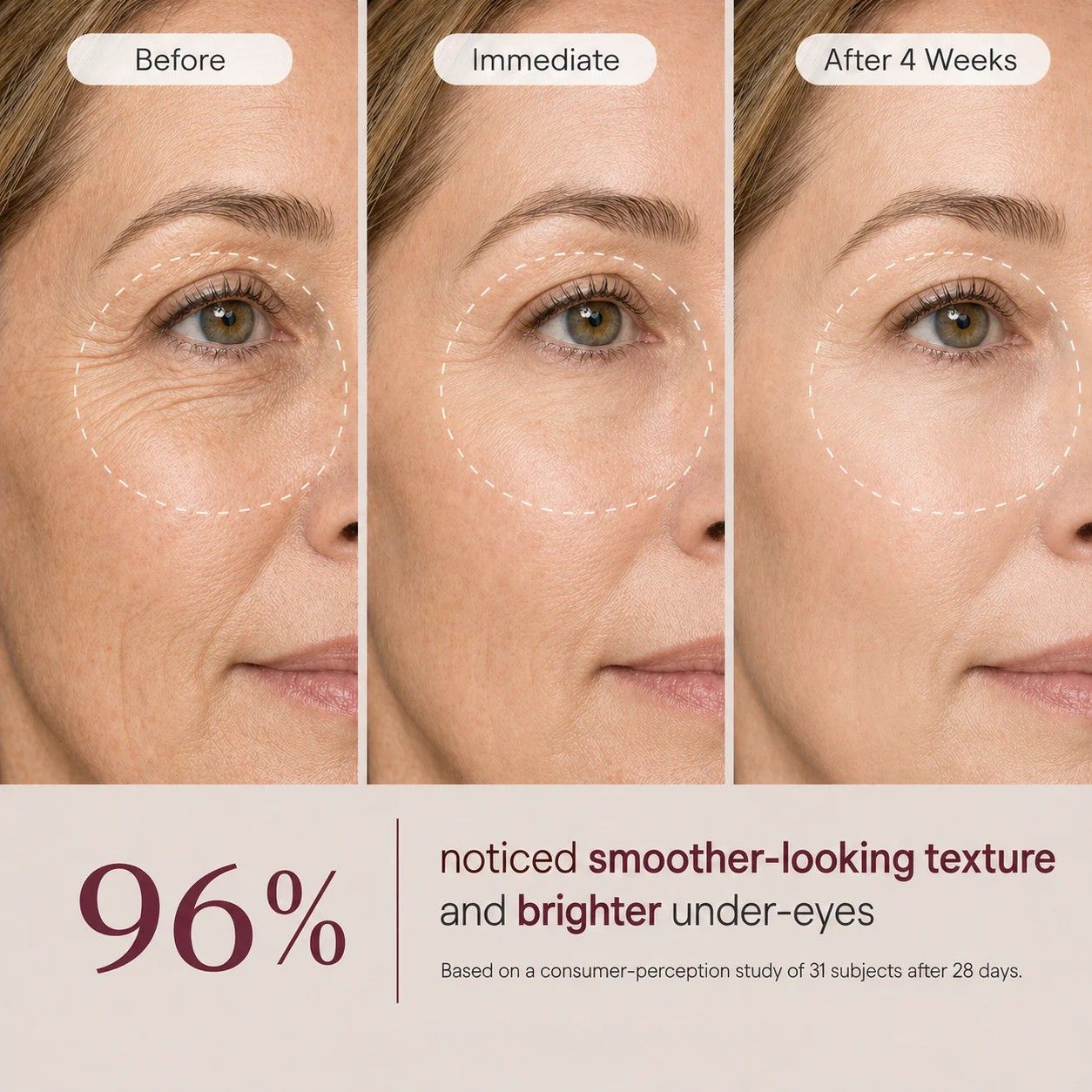 Avalia® Brighten & Lift Calcium Eye Cream
