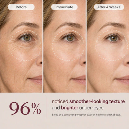 Avalia® Brighten & Lift Calcium Eye Cream