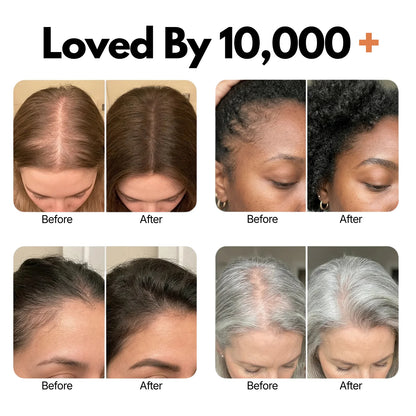 Avalia® Root Revival Serum