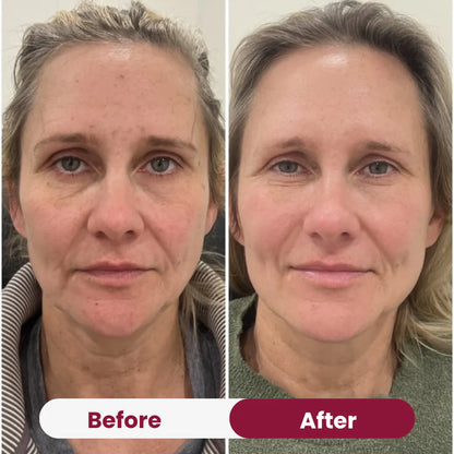 Avalia® Hydrogel Eye Patch