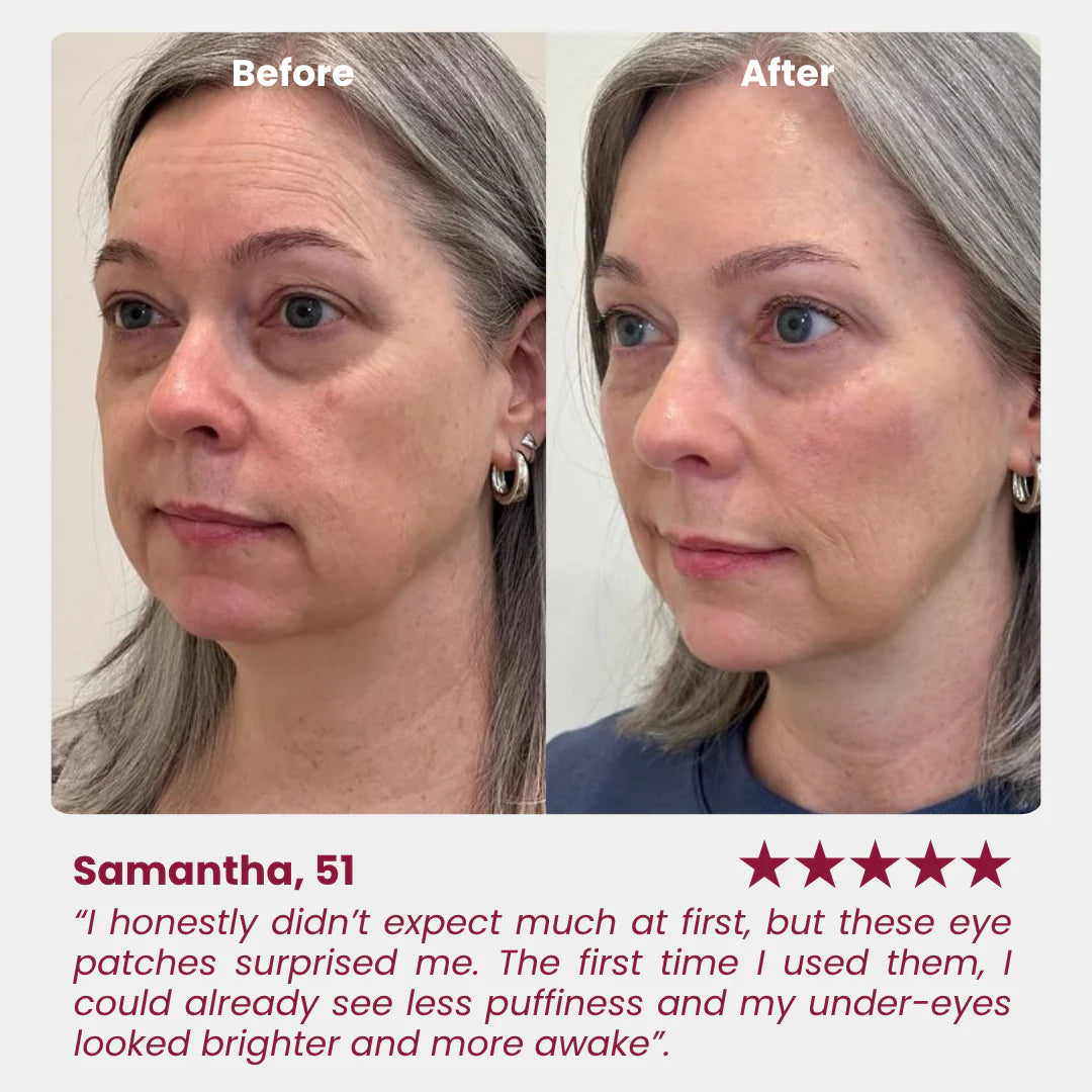 Avalia® Hydrogel Eye Patch
