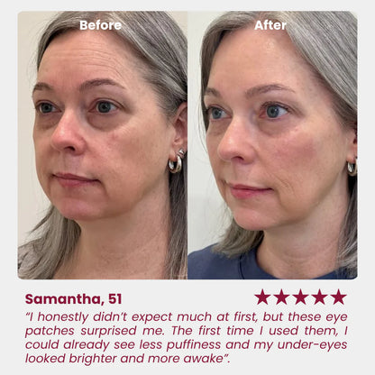 Avalia® Hydrogel Eye Patch