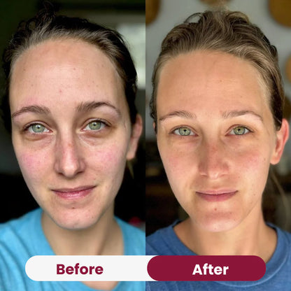 Avalia® Hydrogel Eye Patch