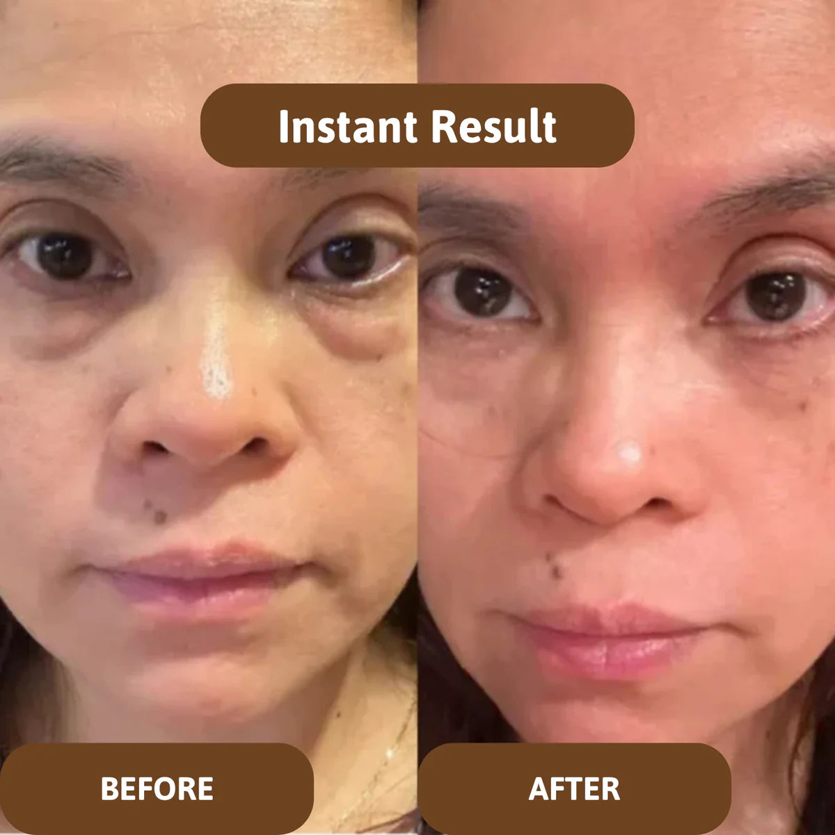 Avalia® Skin Barrier Balm