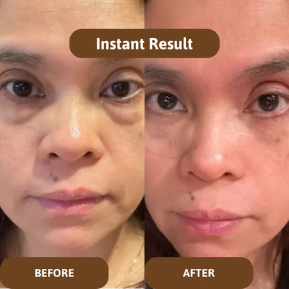 Avalia® Skin Barrier Balm
