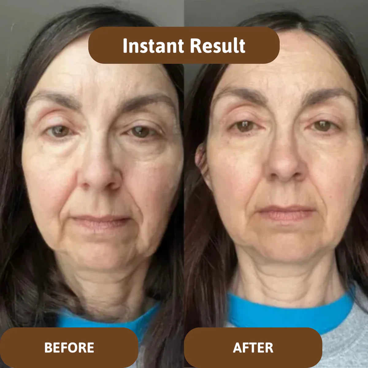 Avalia® Skin Barrier Balm
