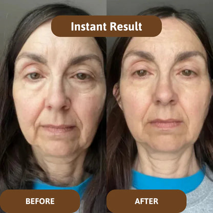 Avalia® Skin Barrier Balm