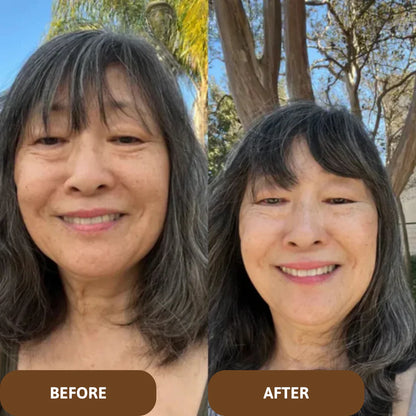 Avalia® Skin Barrier Balm