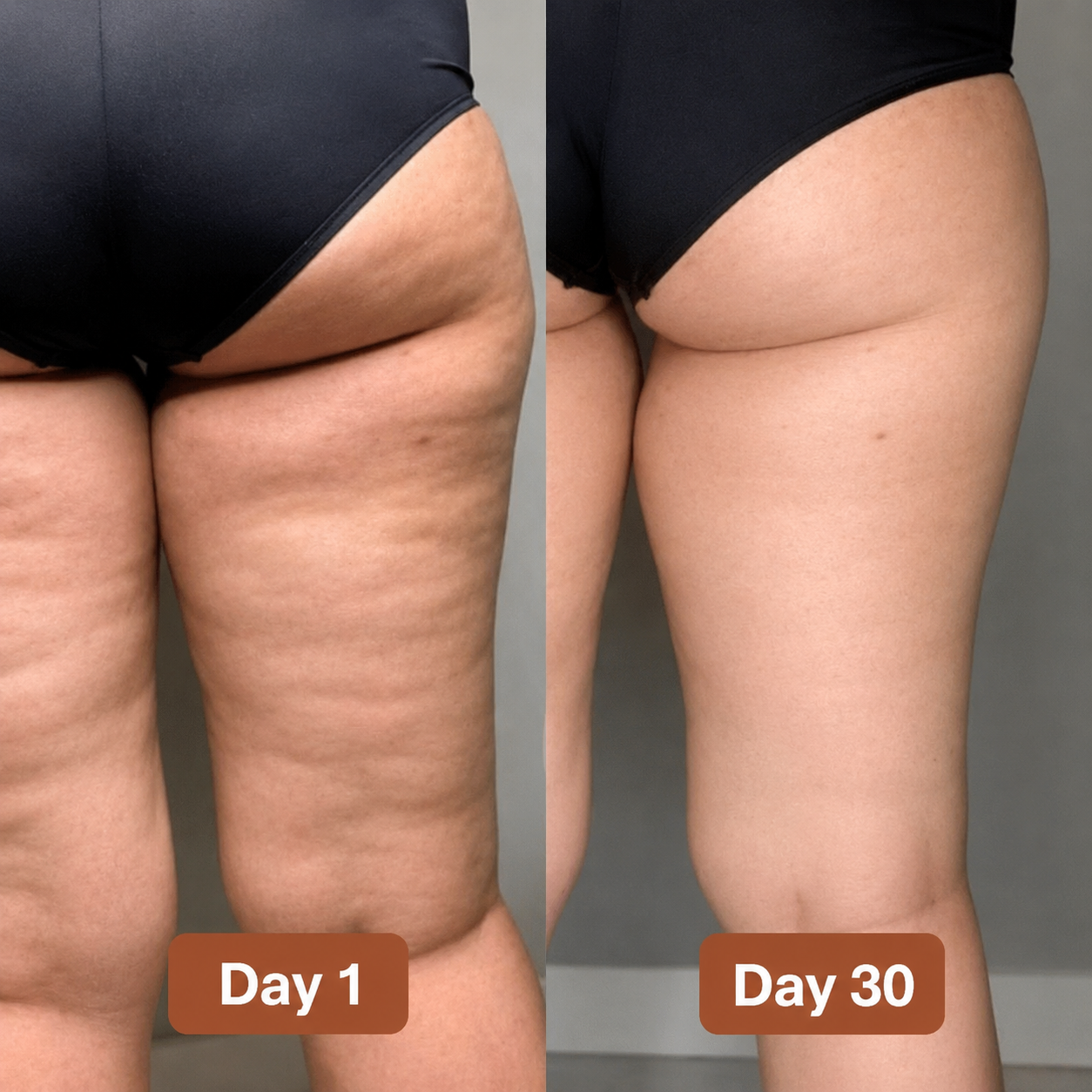 Avalia® 3D Relief Leggings - For Women With Lipedema, Swollen & Heavy Legs
